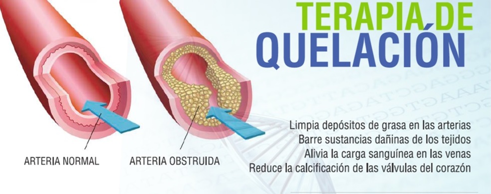 Terapia de Quelación